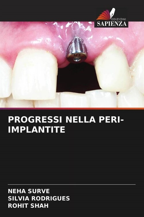 PROGRESSI NELLA PERI-IMPLANTITE (Paperback)