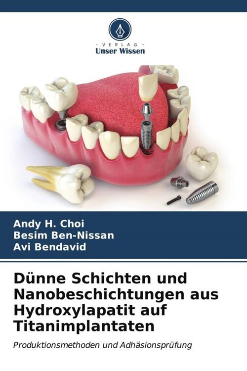 Dunne Schichten und Nanobeschichtungen aus Hydroxylapatit auf Titanimplantaten (Paperback)