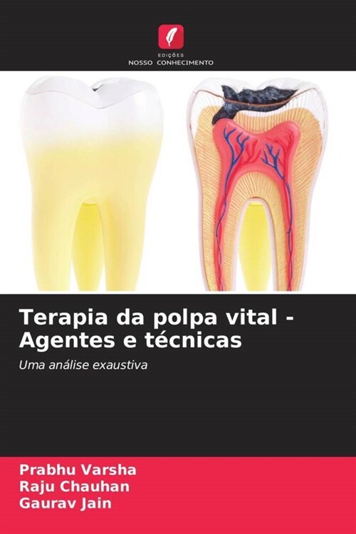 Terapia da polpa vital - Agentes e tecnicas (Paperback)