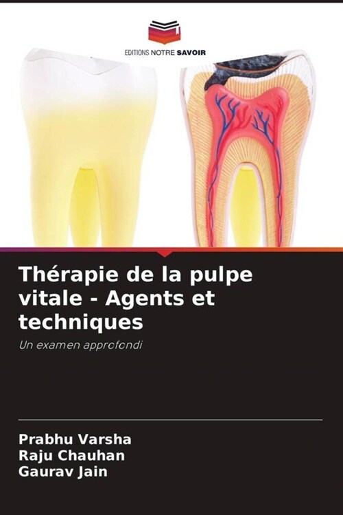 Therapie de la pulpe vitale - Agents et techniques (Paperback)