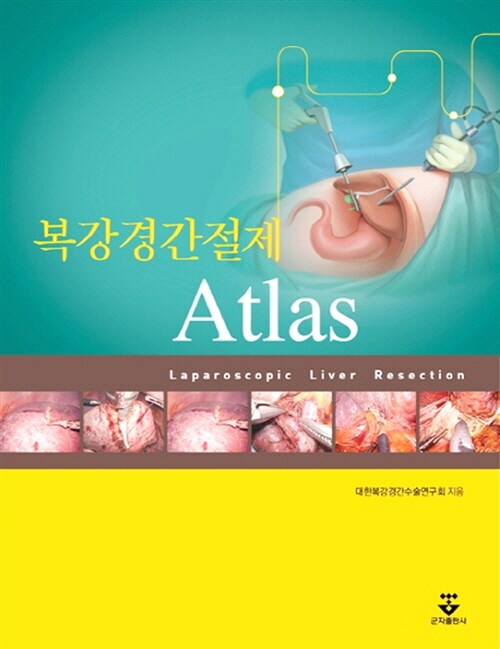 복강경간절제 Atlas