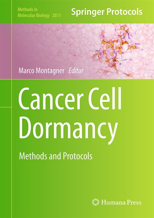 Cancer Cell Dormancy: Methods and Protocols (Hardcover, 2024)