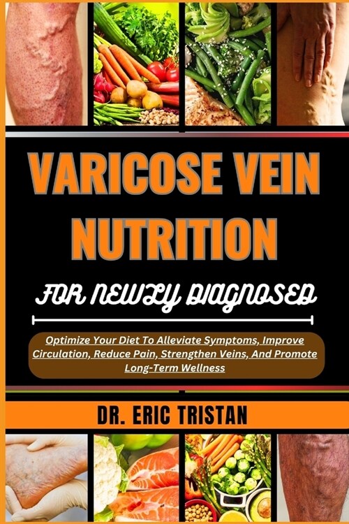 Varicose Vein Nutrition for Newly Diagnosed: Optimize Your Diet To Alleviate Symptoms, Improve Circulation, Reduce Pain, Strengthen Veins, And Promote (Paperback)