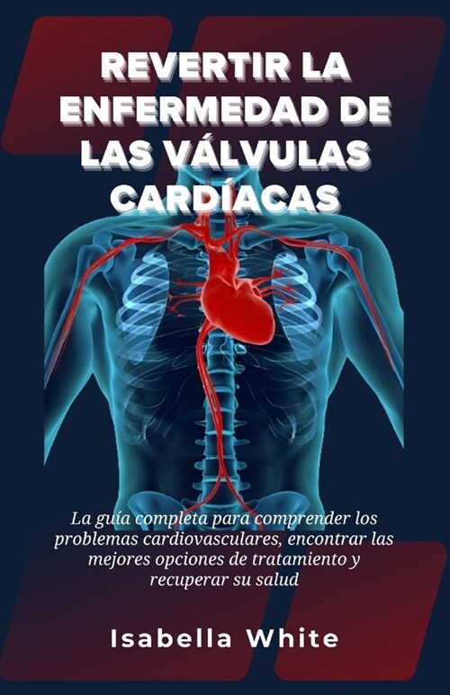 Revertir la Enfermedad de las V?vulas Card?cas: La gu? completa para comprender los problemas cardiovasculares, encontrar las mejores opciones de t (Paperback)