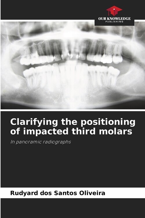 Clarifying the positioning of impacted third molars (Paperback)