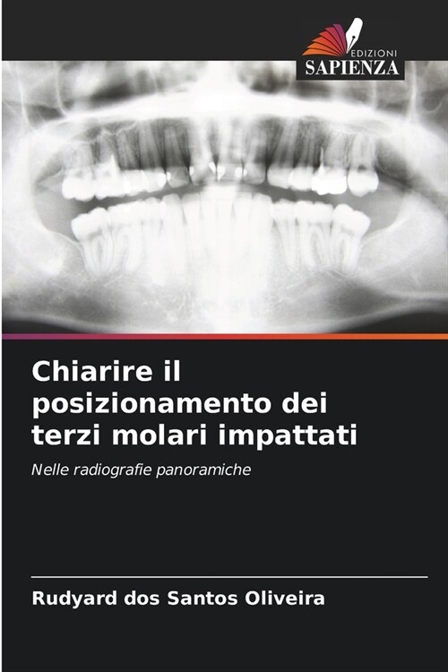 Chiarire il posizionamento dei terzi molari impattati (Paperback)