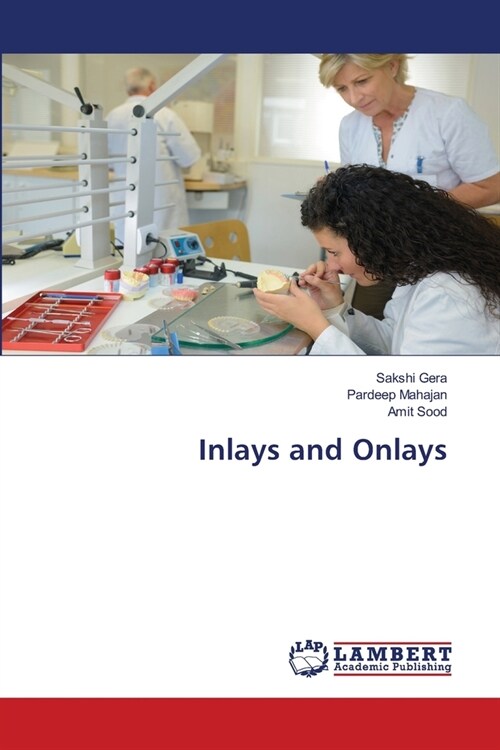 Inlays and Onlays (Paperback)