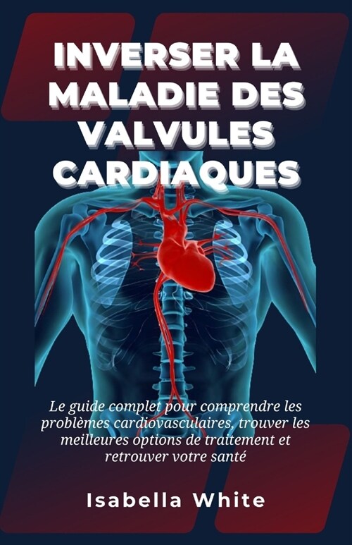 Inverser la Maladie des Valvules Cardiaques: Le guide complet pour comprendre les probl?es cardiovasculaires, trouver les meilleures options de trait (Paperback)