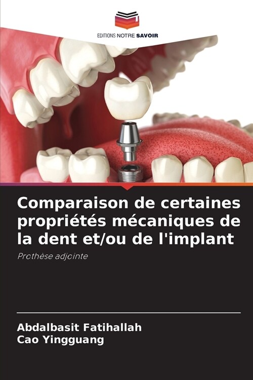 Comparaison de certaines propri?? m?aniques de la dent et/ou de limplant (Paperback)