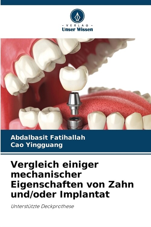 Vergleich einiger mechanischer Eigenschaften von Zahn und/oder Implantat (Paperback)