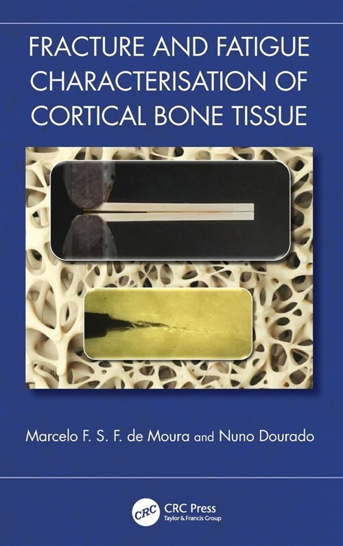 Fracture and Fatigue Characterisation of Cortical Bone Tissue (Hardcover)