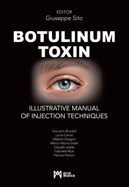 Botulinum Toxin (Hardcover)