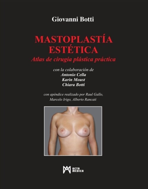 Mastoplastía Estética (Hardcover)