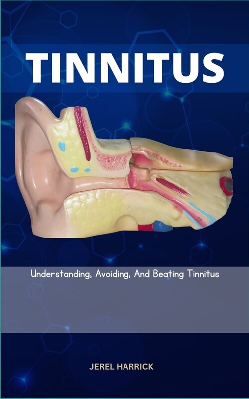 Tinnitus: Understanding, Avoiding, And Beating Tinnitus (Paperback)