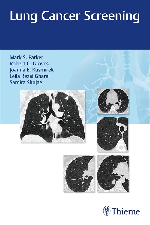 Lung Cancer Screening (eBook Code, 1st)