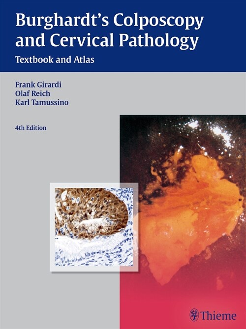 Burghardts Colposcopy and Cervical Pathology (eBook Code, 4th)