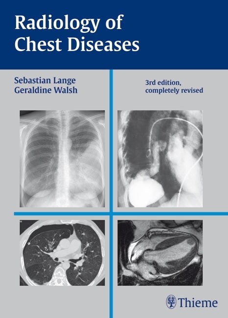 Radiology of Chest Diseases (eBook Code, 3rd)