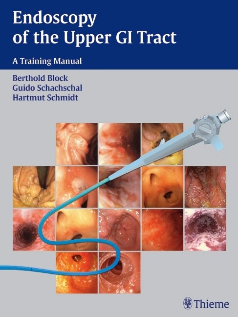 Endoscopy of the Upper GI Tract (eBook Code, 1st)