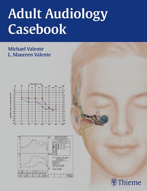 Adult Audiology Casebook (eBook Code, 1st)