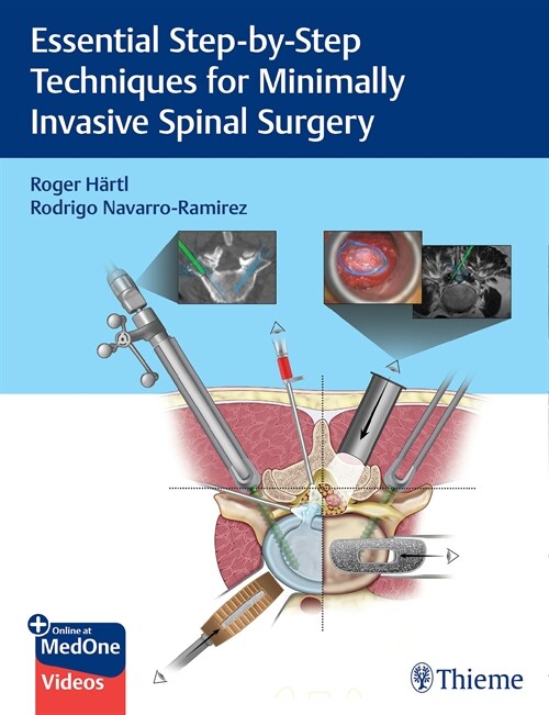 Essential Step-by-Step Techniques for Minimally Invasive Spinal Surgery (eBook Code, 1st)