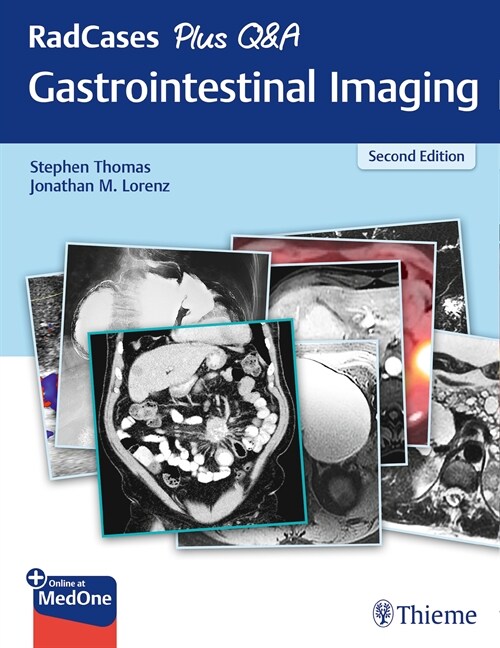 RadCases Plus Q&A Gastrointestinal Imaging (eBook Code, 2nd)