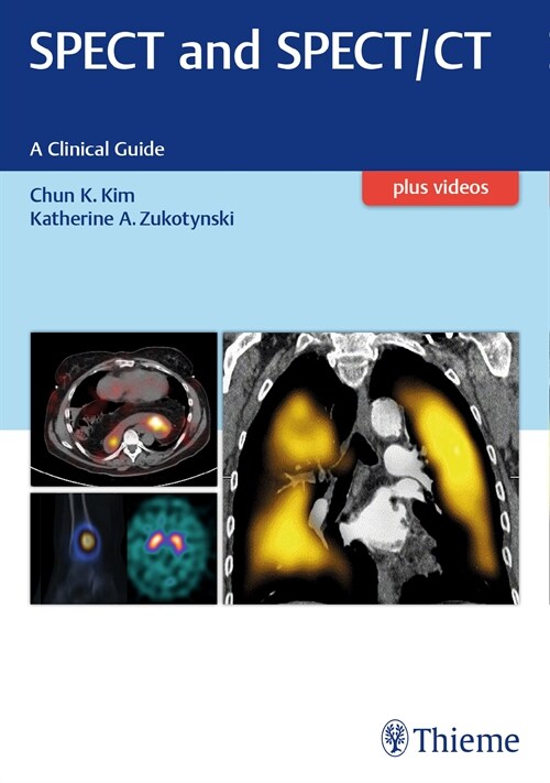 SPECT and SPECT/CT (eBook Code, 1st)