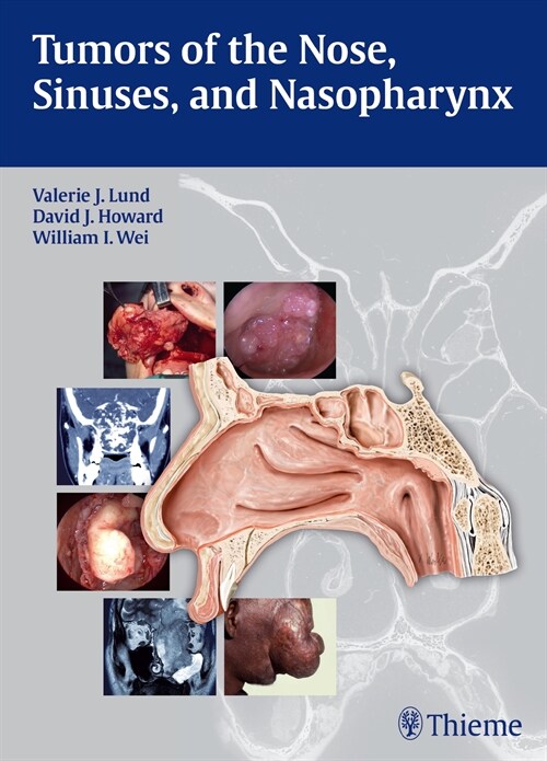 Tumors of the Nose, Sinuses and Nasopharynx (eBook Code, 1st)