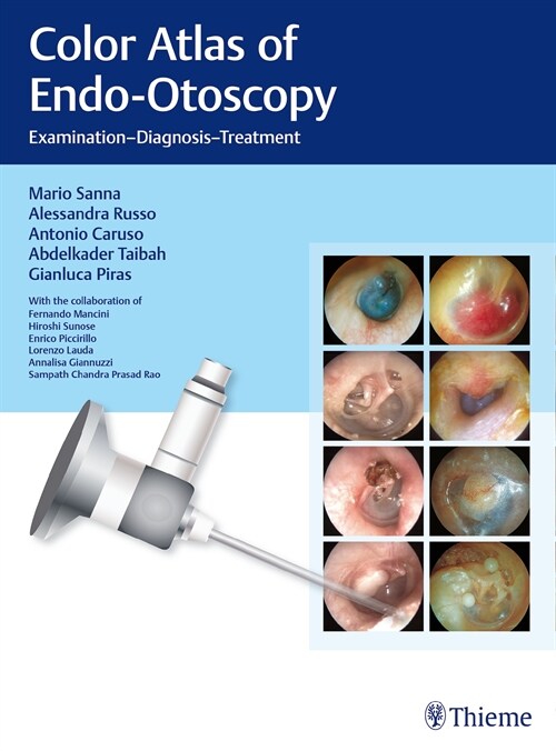 Color Atlas of Endo-Otoscopy (eBook Code, 1st)