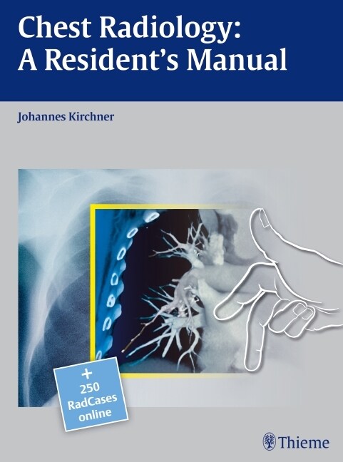 Chest Radiology: A Residents Manual (eBook Code, 1st)