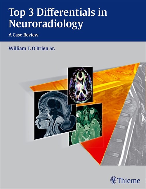 Top 3 Differentials in Neuroradiology (eBook Code, 1st)