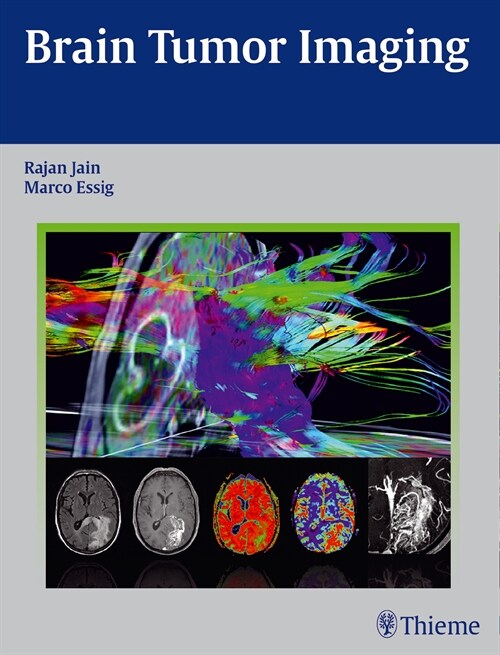 Brain Tumor Imaging (eBook Code, 1st)