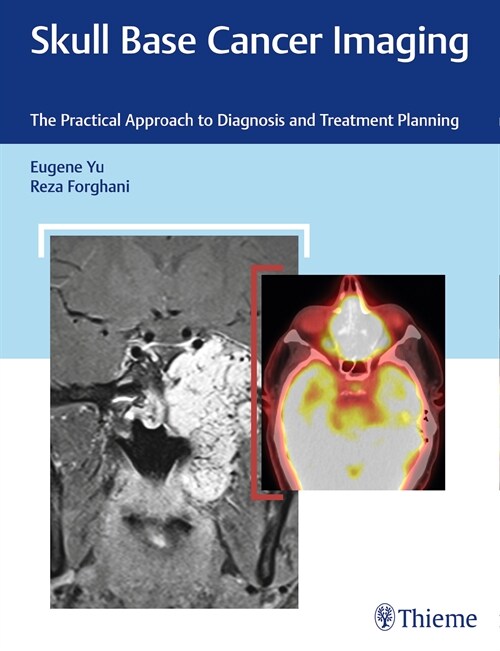 Skull Base Cancer Imaging (eBook Code, 1st)