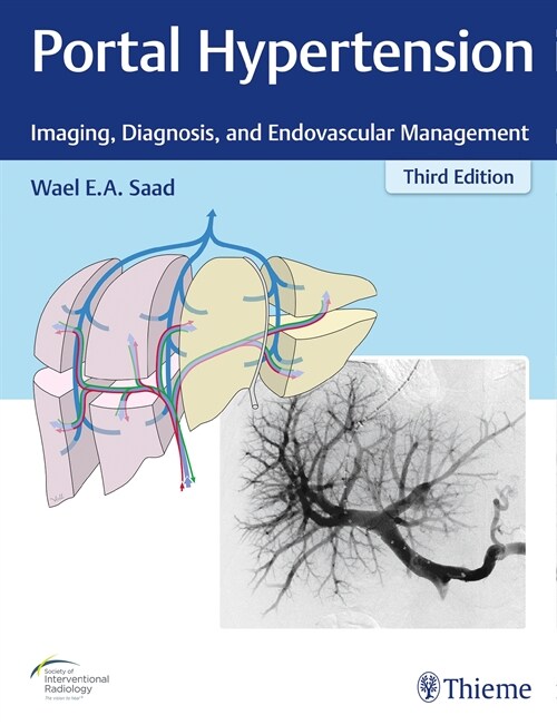 Portal Hypertension (eBook Code, 3rd)