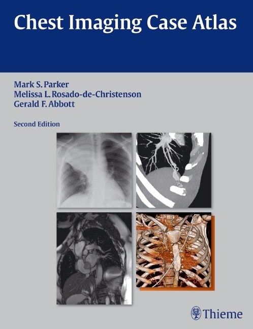 Chest Imaging Case Atlas (eBook Code, 2nd)