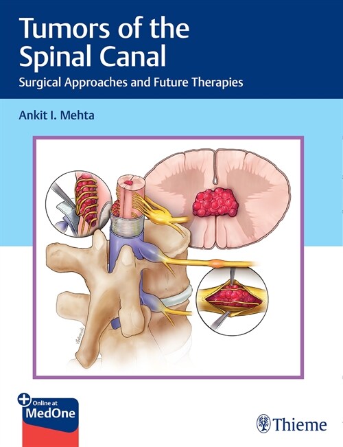 Tumors of the Spinal Canal (eBook Code, 1st)