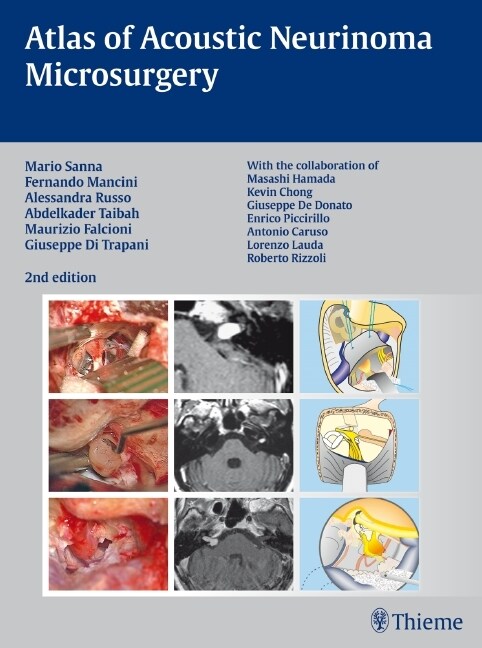 Atlas of Acoustic Neurinoma Microsurgery (eBook Code, 2nd)