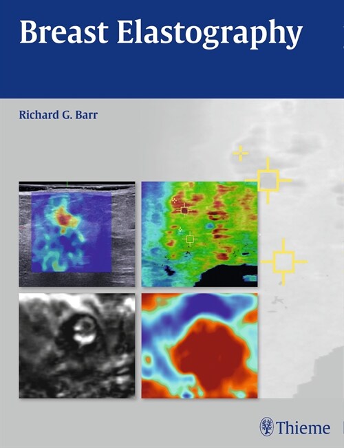 Breast Elastography (eBook Code, 1st)