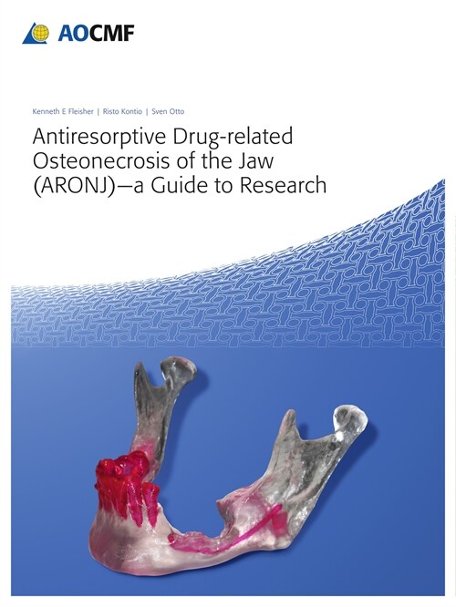 Antiresorptive Drug-Related Osteonecrosis of the Jaw (ARONJ) - A Guide to Research (eBook Code, 1st)