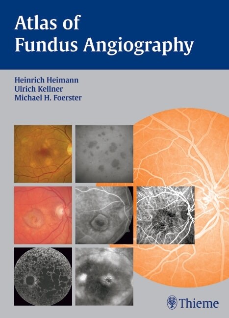Atlas of Fundus Angiography (eBook Code, 1st)