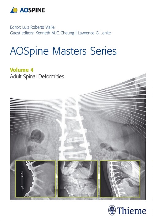 AOSpine Master Series, Vol. 4: Adult Spinal Deformities (eBook Code, 1st)