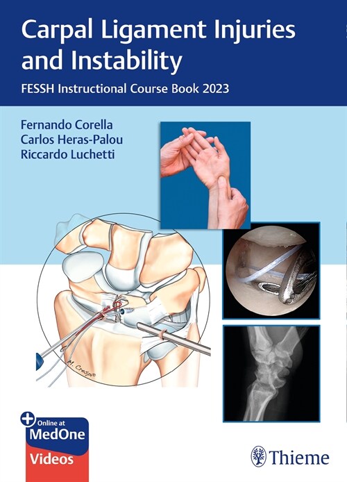 Carpal Ligament Injuries and Instability (eBook Code, 1st)