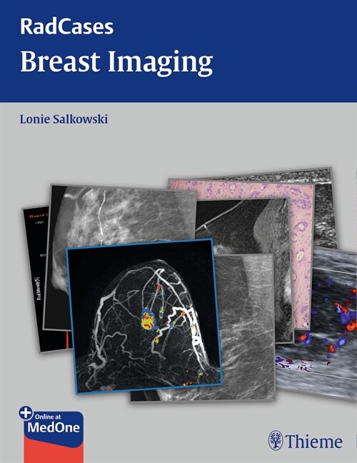 Radcases Breast Imaging (eBook Code, 1st)