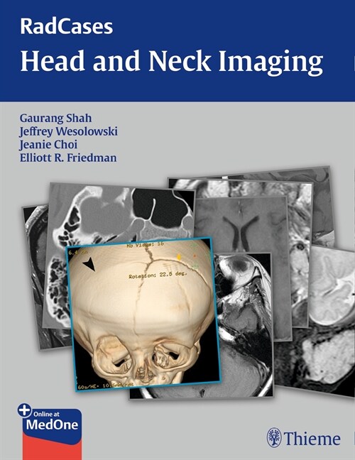 RadCases Head and Neck Imaging (eBook Code, 1st)