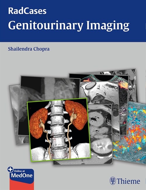 Radcases Genitourinary Imaging (eBook Code, 1st)