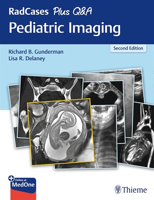 RadCases Plus Q&A Pediatric Imaging (eBook Code, 2nd)