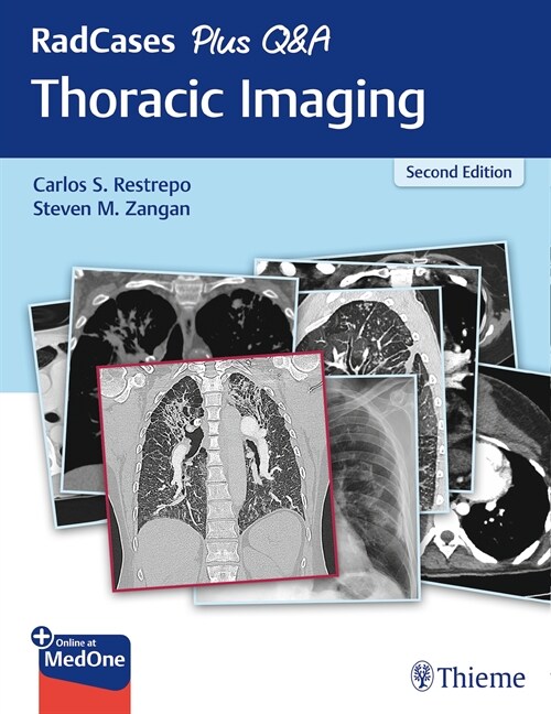 RadCases Plus Q&A Thoracic Imaging (eBook Code, 2nd)