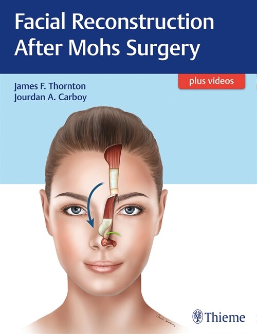 Facial Reconstruction After Mohs Surgery (eBook Code, 1st)