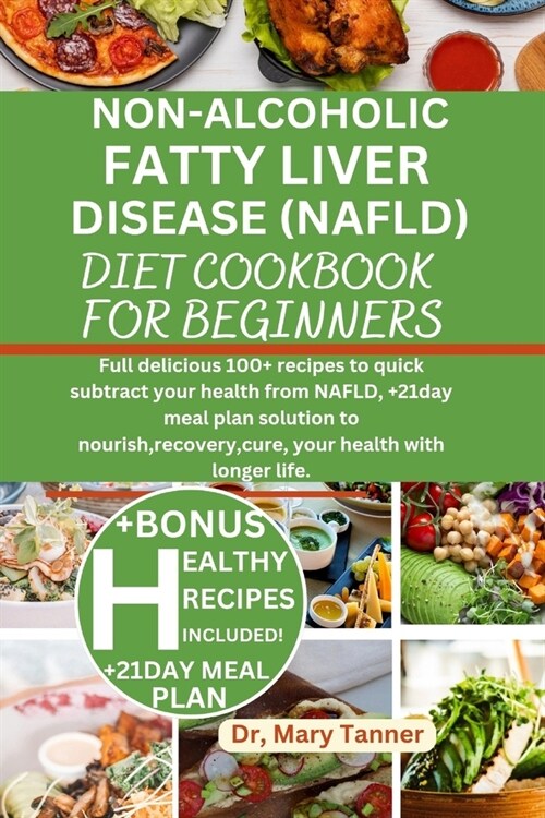 Non-Alcoholic Fatty Liver Disease (Nafld) Diet: Full delicious 100+ recipes to quick subtract your health from NAFLD, +21day meal plan solution to nou (Paperback)