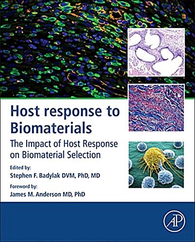 Host Response to Biomaterials: The Impact of Host Response on Biomaterial Selection (Hardcover)