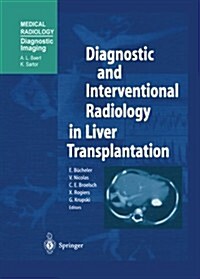 Diagnostic and Interventional Radiology in Liver Transplantation (Paperback, 2003)